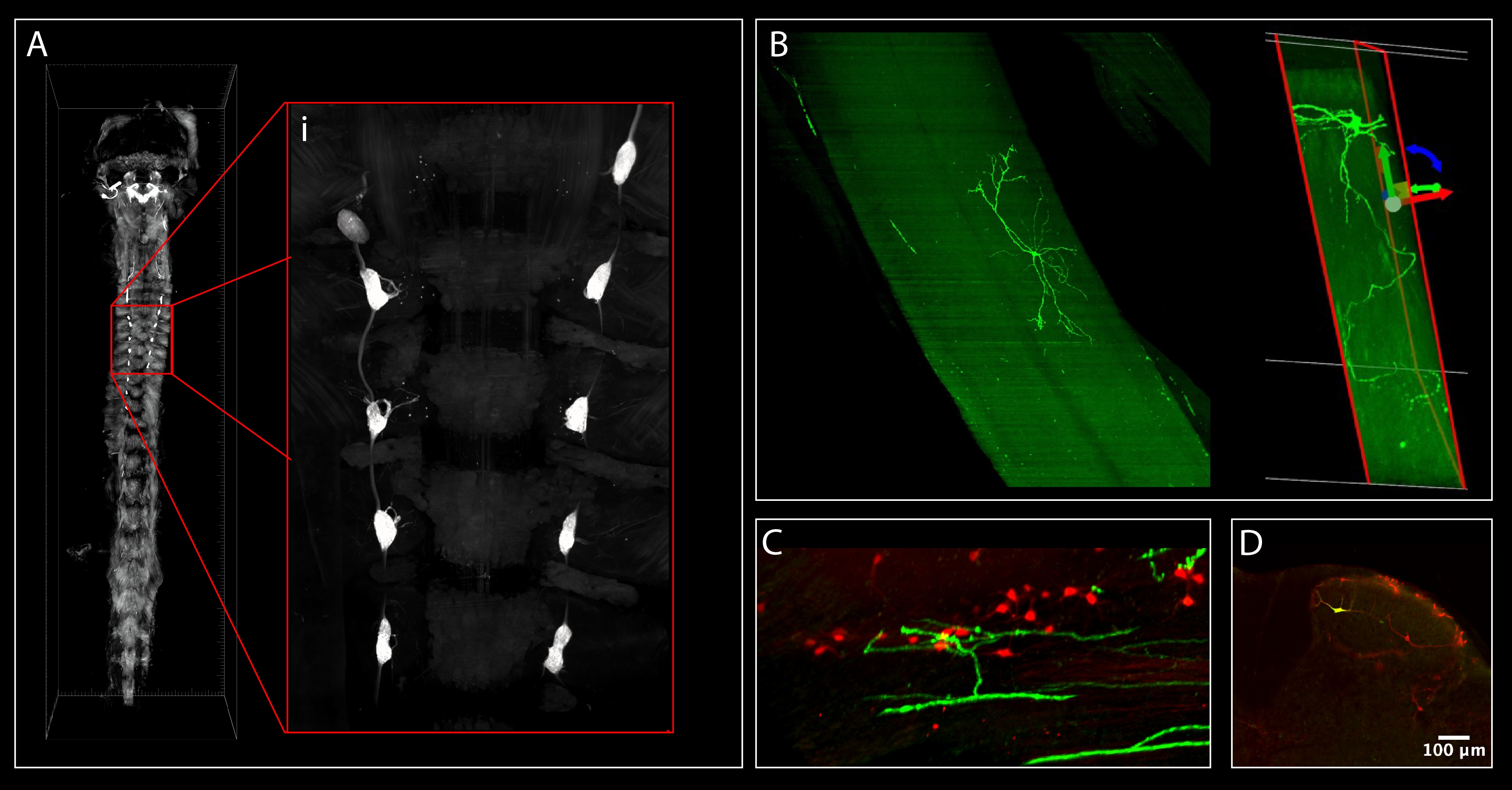 Spinal cord calcium imaging