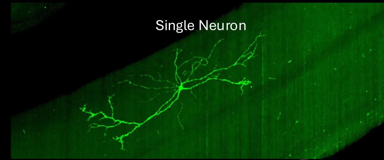 A single sparsely-labeled spinal projection neuron expressing GFP, its dendritic arbor visible against a green background