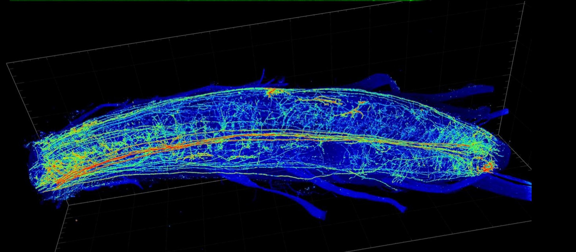 Light-sheet reconstruction of a cleared mouse spinal cord, sparsely labeled projection neurons rendered in blue and orange