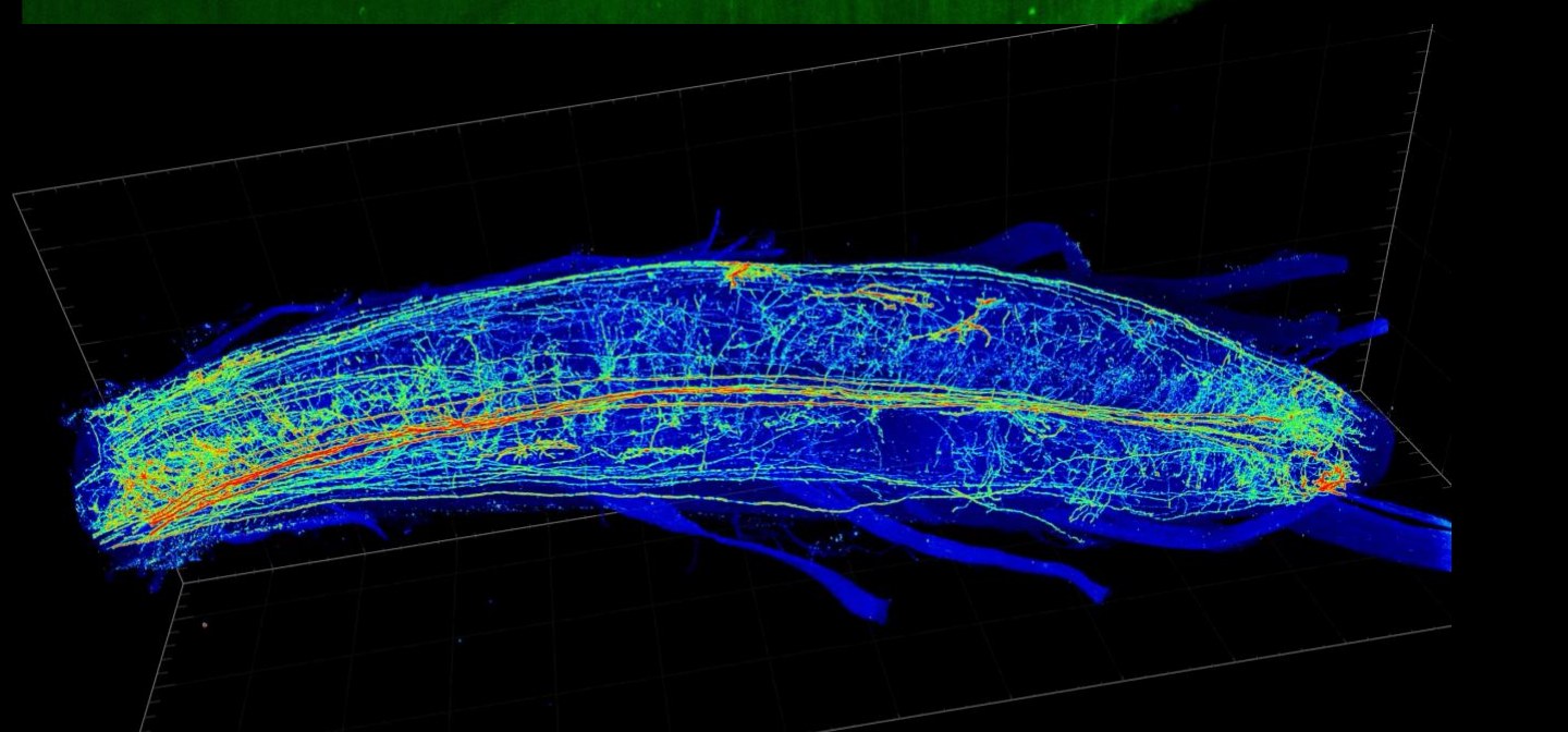Three-dimensional light-sheet reconstruction of a cleared spinal cord with labeled fibers rendered in blue, green and orange